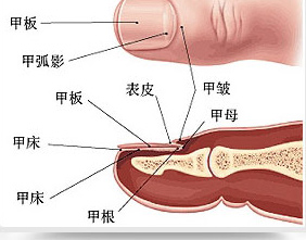灰指甲